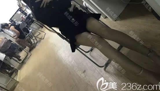 我在南寧韓成整形做腿部吸脂第30天