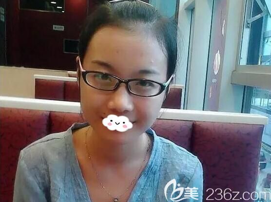 進(jìn)入成都美極工作未蛻變前照片 進(jìn)入成都美極工作未蛻變前照片