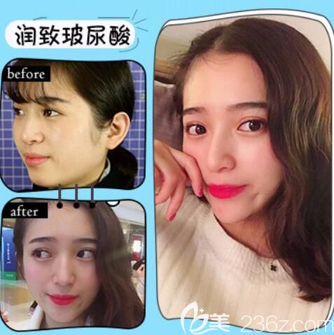 合肥韓美醫(yī)院怎么樣，好不好？真人案例+評價來驗證