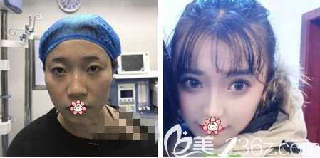 重慶藝星整形哪位醫(yī)生做雙眼皮比較好 重慶藝星整形哪位醫(yī)生做雙眼皮比較好