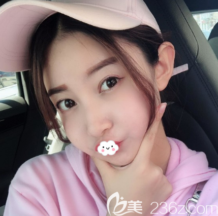 荊州隆鼻修復(fù)哪里好？荊州華美李杰真人案例