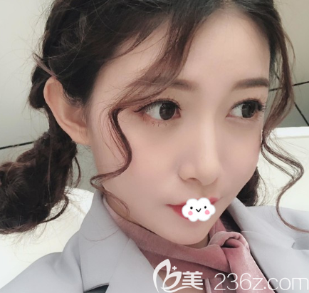 荊州隆鼻失敗修復(fù)哪家醫(yī)院整形效果好?找荊州華美李杰做鼻綜合修復(fù)歪鼻