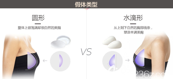 假體類型 假體類型