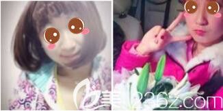 醫(yī)院整形美容科孫海榮瘦臉除皺瘦臉真人案例 醫(yī)院整形美容科孫海榮瘦臉除皺瘦臉真人案例