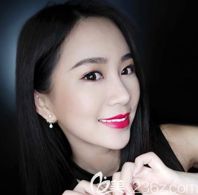 深圳鵬程醫(yī)院李子鵬做隆鼻在怎么樣 深圳鵬程醫(yī)院李子鵬做隆鼻在怎么樣