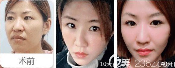 常州美貝爾面部年輕化