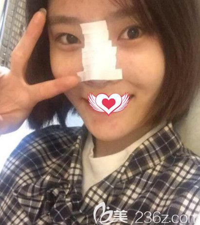 在<!--<i data=20240703-sp></i>-->做隆鼻術(shù)后鼻子微腫