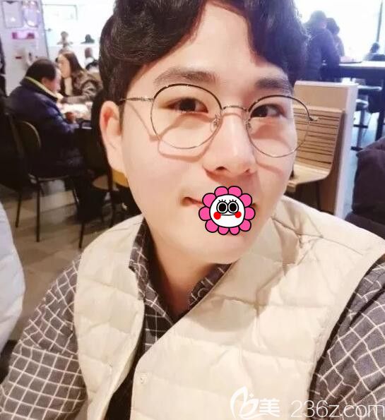 被朋友嘲笑眼睛像天狼星一樣小，于是找韓國(guó)BK整形李丙濬院長(zhǎng)做了雙眼皮和鼻整形術(shù)