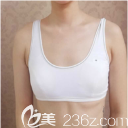 我的術(shù)前照 我的術(shù)前照