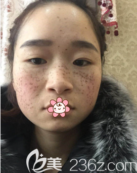 趙蓉醫(yī)生給我手術(shù)當(dāng)天 趙蓉醫(yī)生給我手術(shù)當(dāng)天