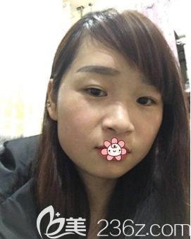 重慶藝星整形祛斑怎么樣 重慶藝星整形祛斑怎么樣