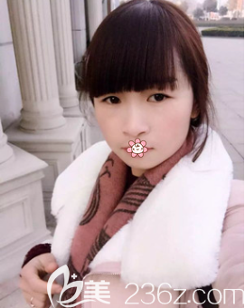 趙蓉激光祛雀斑術(shù)后3個月 趙蓉激光祛雀斑術(shù)后3個月