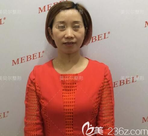 到蘇州美貝爾面診術(shù)前面部凹陷顯老 到蘇州美貝爾面診術(shù)前面部凹陷顯老