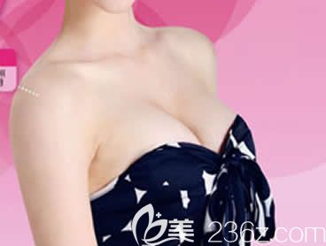 反饋:我在柳州華美整形做曼托水滴形假體隆胸術(shù)后1個月胸部變軟手感自然