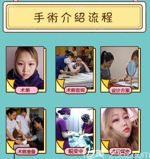 東莞韓美李陽院長隆鼻手術(shù)流程示意圖 東莞韓美李陽院長隆鼻手術(shù)流程示意圖