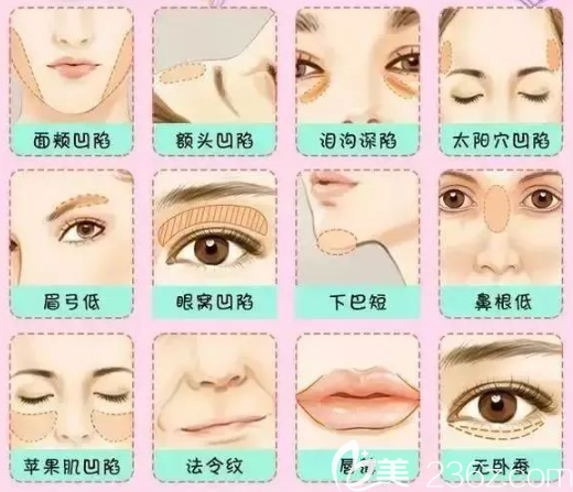 面部衰老跡象
