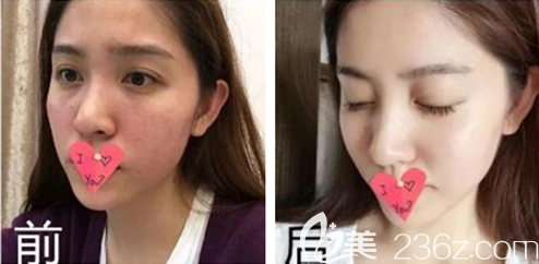 貴陽美貝爾多少錢