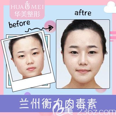 汕頭華美瘦臉680元附案例 汕頭華美瘦臉680元附案例