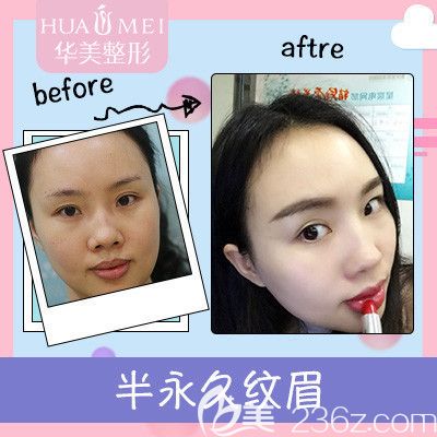汕頭華美半紋眉案例對(duì)比圖 汕頭華美半紋眉案例對(duì)比圖