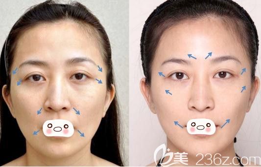 洛陽華美<!--<i data=20240703-sp></i>-->案例 洛陽華美<!--<i data=20240703-sp></i>-->案例