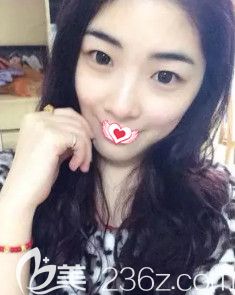 在保定藍(lán)山做鼻綜合術(shù)前鼻子塌平 在保定藍(lán)山做鼻綜合術(shù)前鼻子塌平