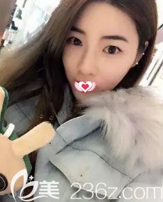 <!--<i data=20240703-sp></i>-->醫(yī)生做鼻綜合10天后鼻子消腫 <!--<i data=20240703-sp></i>-->醫(yī)生做鼻綜合10天后鼻子消腫