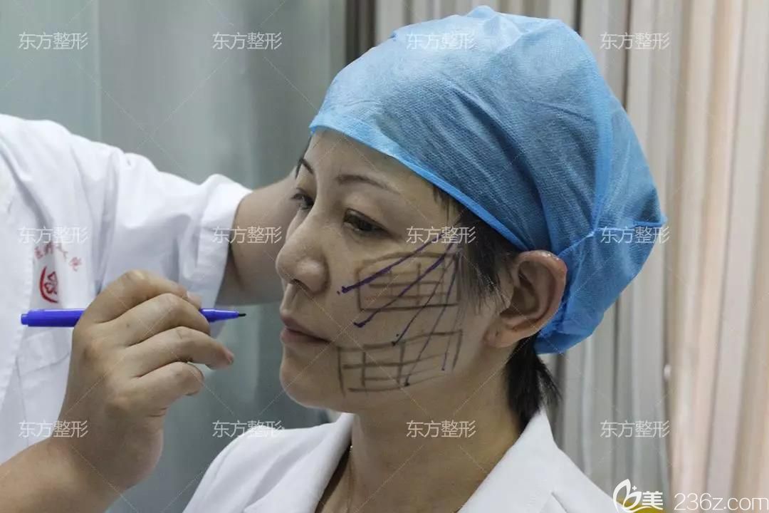 我在南寧東方整形做面部埋線提升術(shù)前設(shè)計(jì) 我在南寧東方整形做面部埋線提升術(shù)前設(shè)計(jì)