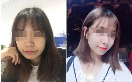 樂山達芬奇術(shù)后效果