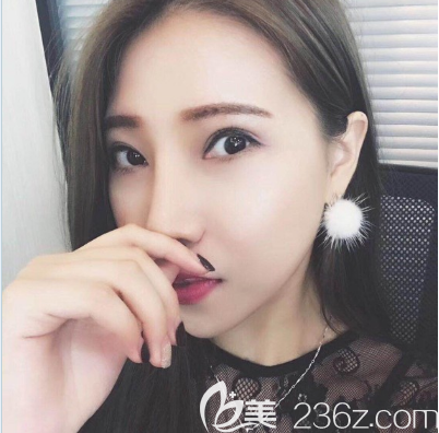 找廣州美恩陳宏彬做了雙眼皮隆鼻手術(shù) 找廣州美恩陳宏彬做了雙眼皮隆鼻手術(shù)