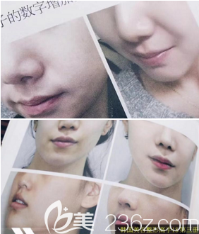 整形18高手書中案例