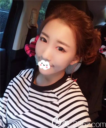 在內(nèi)江達(dá)芬奇嘗試了閨蜜推薦的全臉脂肪填充手術(shù)，果然擺脫了面部凹陷的大媽臉