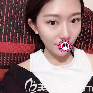 北京藝星醫(yī)療美容醫(yī)院眼綜合案例 北京藝星醫(yī)療美容醫(yī)院眼綜合案例