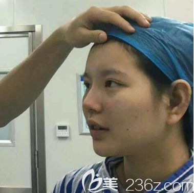 在廣州藝美做隆鼻術(shù)前照片 在廣州藝美做隆鼻術(shù)前照片