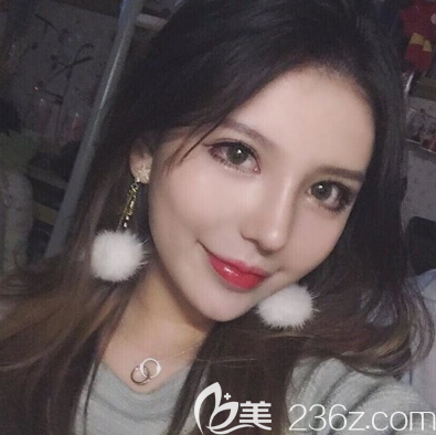 廣州藝美李闖做隆鼻和脂肪填充怎么樣 廣州藝美李闖做隆鼻和脂肪填充怎么樣