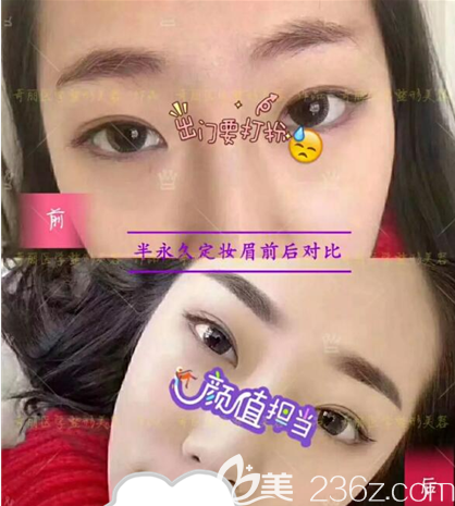 攀枝花奇麗半紋眉術(shù)前后對比效果