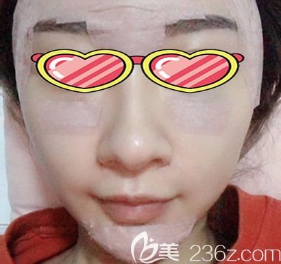 全臉脂肪填充天