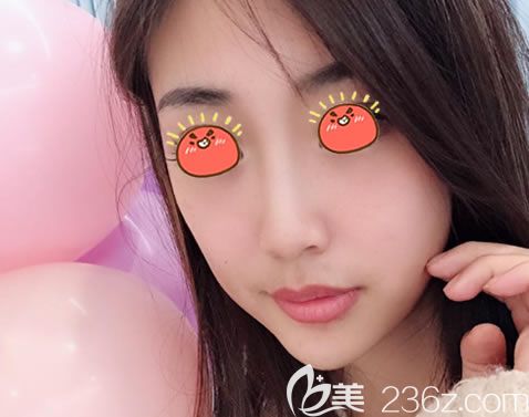 寧波薇琳<!--<i data=20240703-sp></i>-->假體隆鼻<span style=