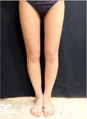 日本吸脂醫(yī)生有哪些?水之森末永裕信給我逆天大長(zhǎng)腿