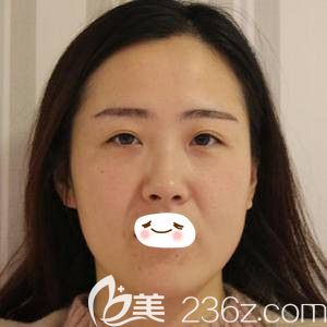 鄭州華領(lǐng)全面部PPDO<span style= 鄭州華領(lǐng)全面部PPDO<span style=