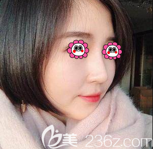 沒想到我在北京雅靚找陳林葉醫(yī)生做完鼻修復(fù)后還可擁有高挺小翹鼻