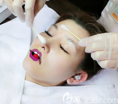 東陽麗萊整形隆鼻手術拆線過程 東陽麗萊整形隆鼻手術拆線過程