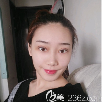 汕頭華美做雙眼皮怎么樣 汕頭華美做雙眼皮怎么樣