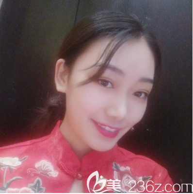 汕頭華美雙眼皮真人案例 汕頭華美雙眼皮真人案例