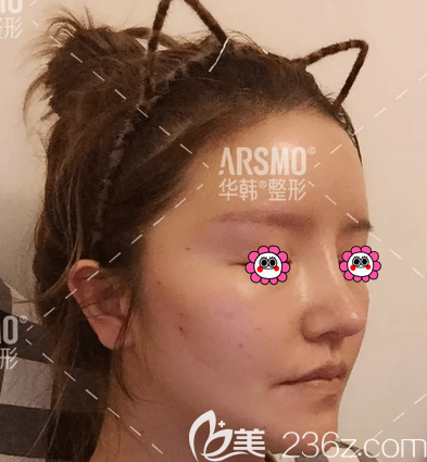 左日宜和陳敏院長給我做6D鉆石<span style= 左日宜和陳敏院長給我做6D鉆石<span style=