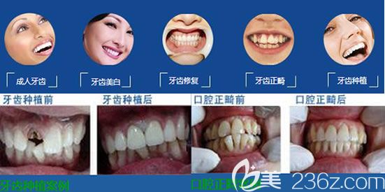 唯美口腔特色診療技術(shù) 唯美口腔特色診療技術(shù)