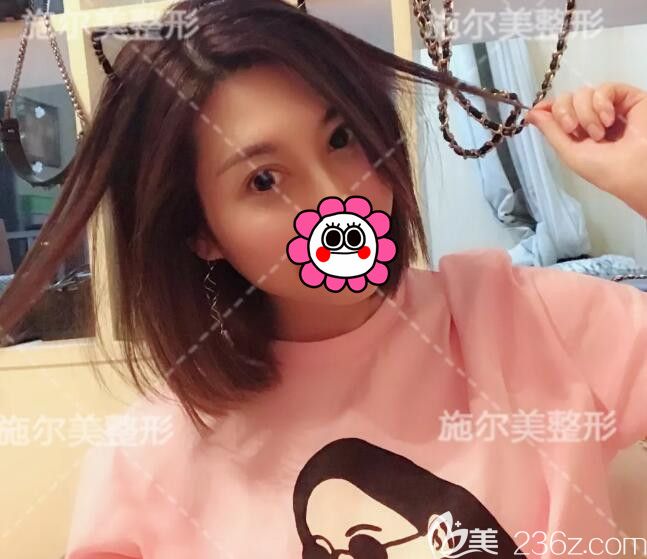 找孫欣主任做去眼袋術(shù)后半年恢復(fù)效果 找孫欣主任做去眼袋術(shù)后半年恢復(fù)效果