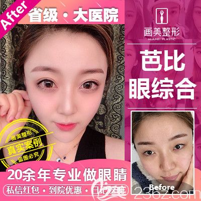 廣東畫美張勇雙眼皮<span style= 廣東畫美張勇雙眼皮<span style=