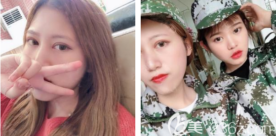 廣州韓妃王媛做雙眼皮怎么樣 廣州韓妃王媛做雙眼皮怎么樣