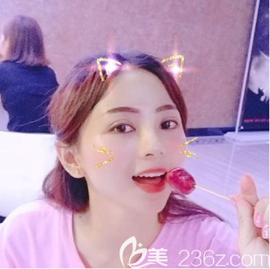 廣州紫馨李政祐做雙眼皮失敗修復怎么樣 廣州紫馨李政祐做雙眼皮失敗修復怎么樣