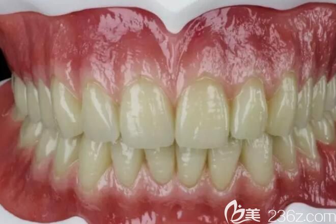 東紅崗擅長BPS吸附式全口義齒 東紅崗擅長BPS吸附式全口義齒